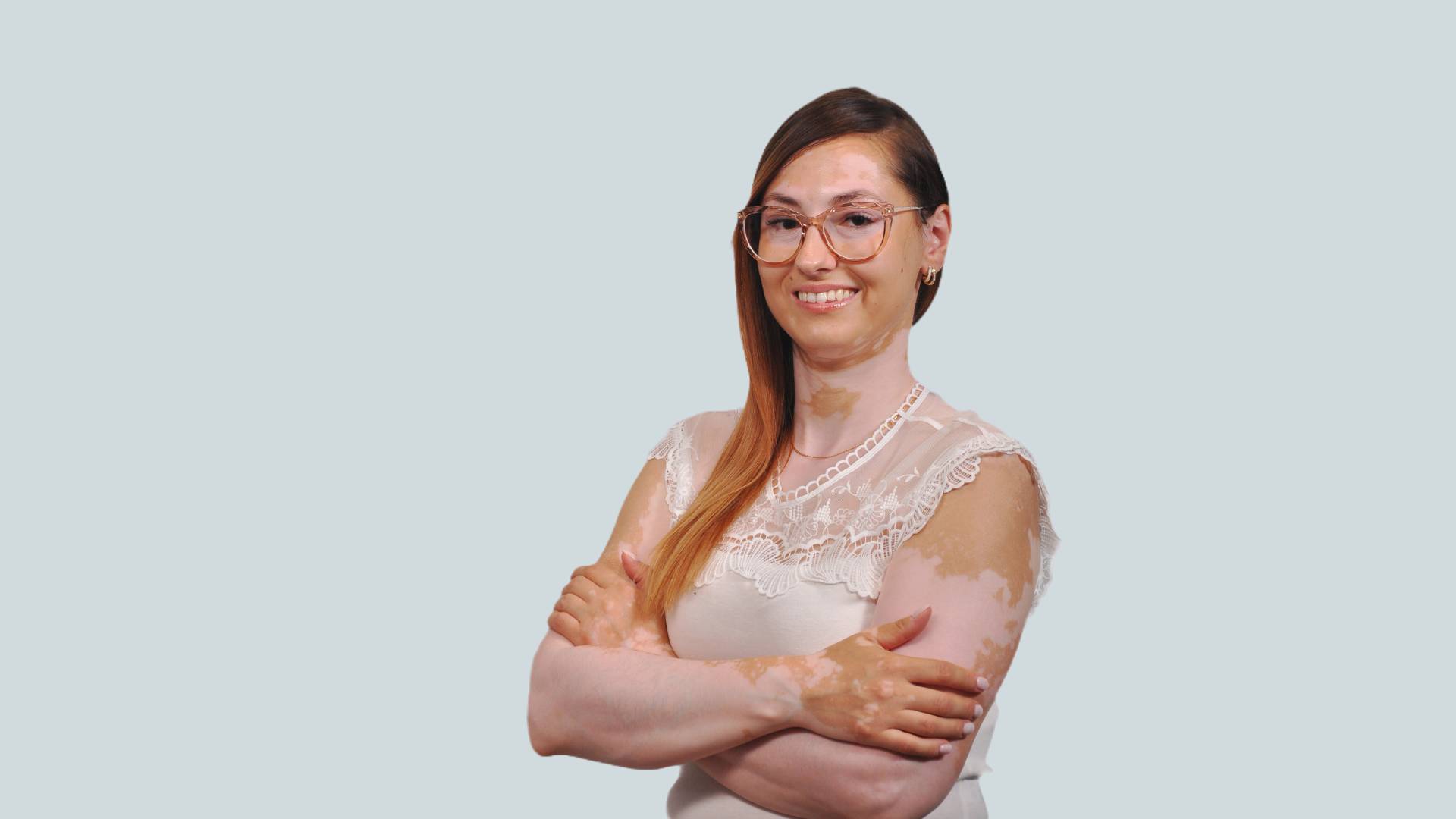 Bielactwo – czy niesie za sobą dyskomfort psychiczny, fizyczny i społeczny?