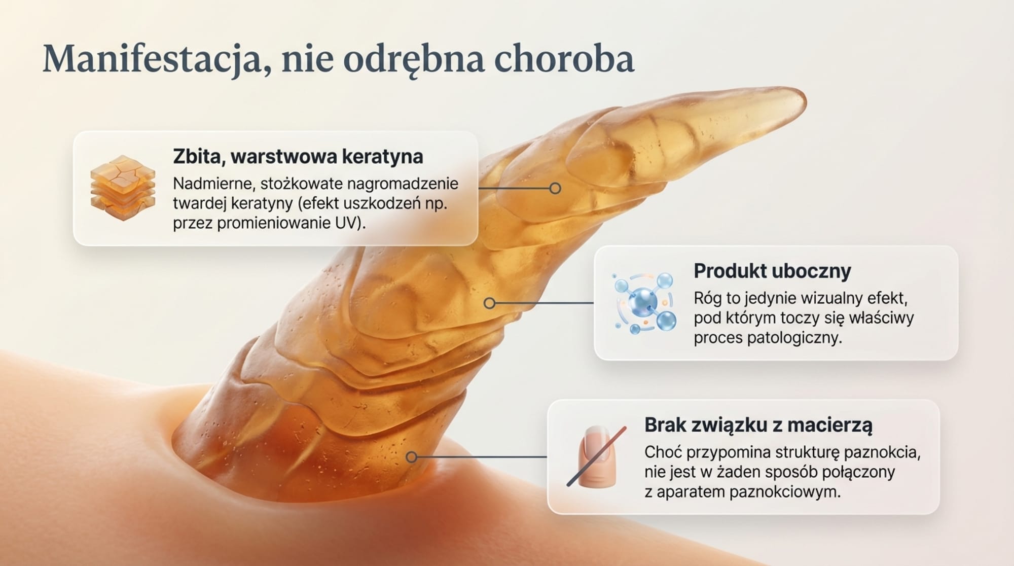 Róg skórny (cornu cutaneum) – znaczenie kliniczne i ryzyko onkologiczne w praktyce podologicznej